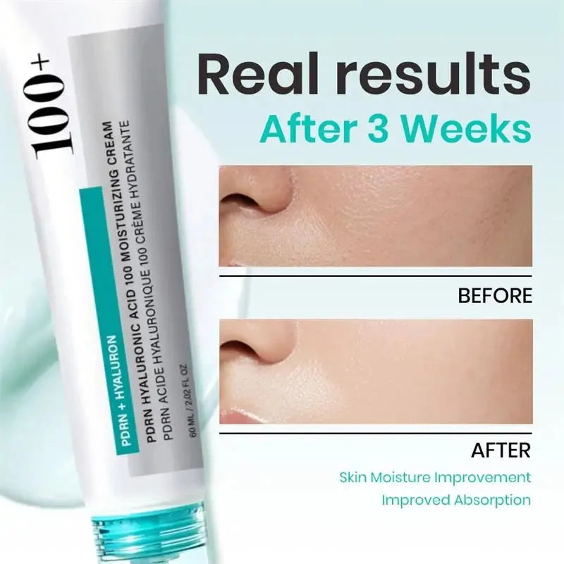 Anua PDRN Hyaluronic Acid 100 Moisturizing Cream 60ml