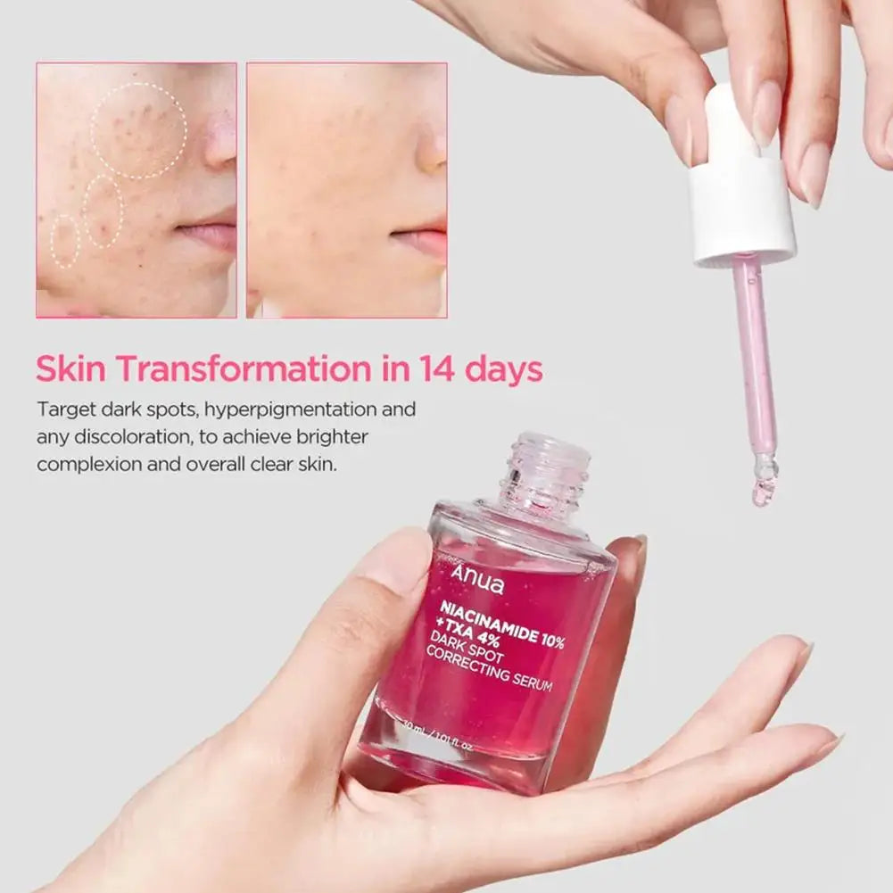 AUNA Niacinamide 10% + 4% Tranexamic Dark Spot Correcting Serum (30ml)